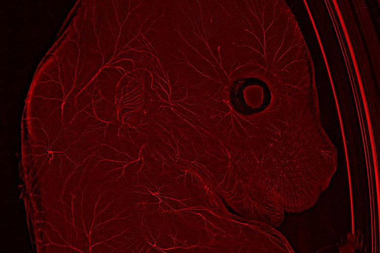 Mouse embryo with THUNDER Imager Model Organism Mouse embryo with THUNDER Imager Model Organism
