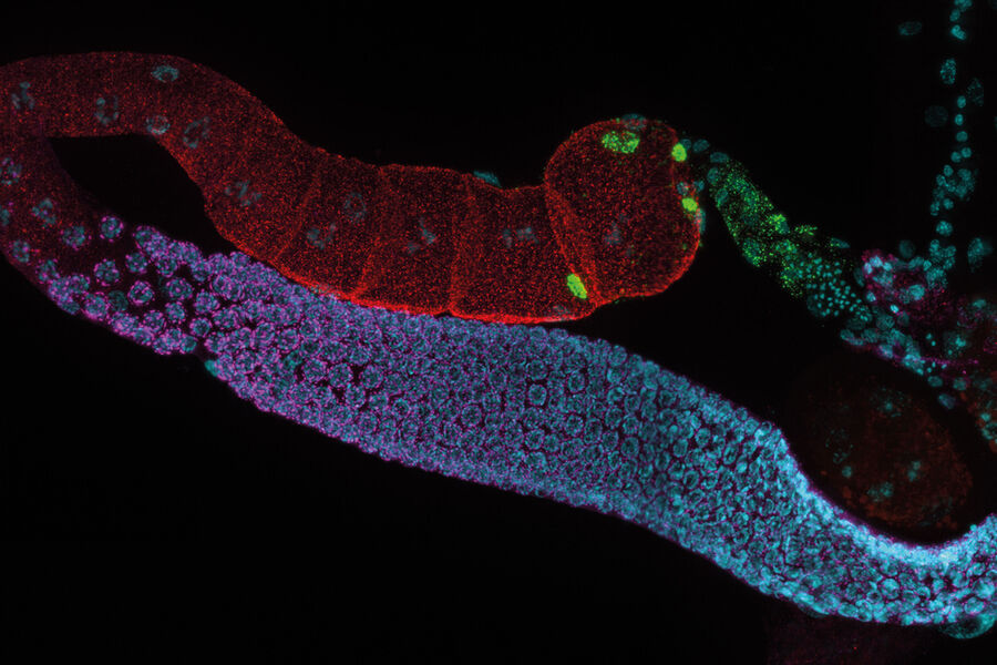 C. elegans adult hermaphrodite gonades acquired using THUNDER Imager C. elegans adult hermaphrodite gonades acquired using THUNDER Imager