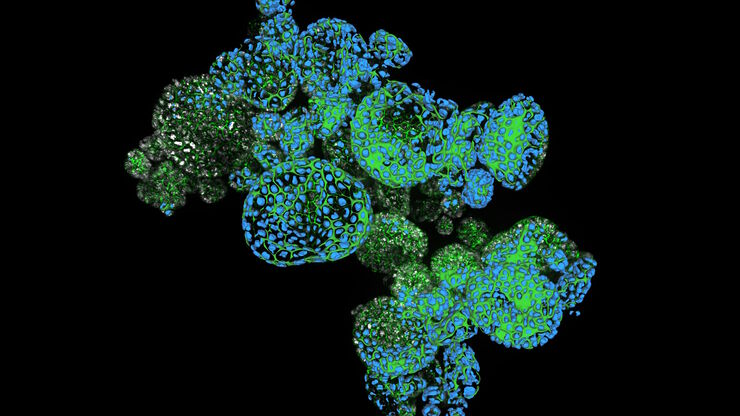 Dapi – Nucleus, GFP – Plasma Membrane, Thickness 100µm, 63x objektive, 469 Z planes, 2 channels, THUNDER Imager 3D Cell Culture. Courtesy M.Sc. Dana Krauß, Medical University of Vienna (Austria). Dapi – Nucleus, GFP – Plasma Membrane, Thickness 100µm, 63x objektive, 469 Z planes, 2 channels, THUNDER Imager 3D Cell Culture. Courtesy M.Sc. Dana Krauß, Medical University of Vienna (Austria).
