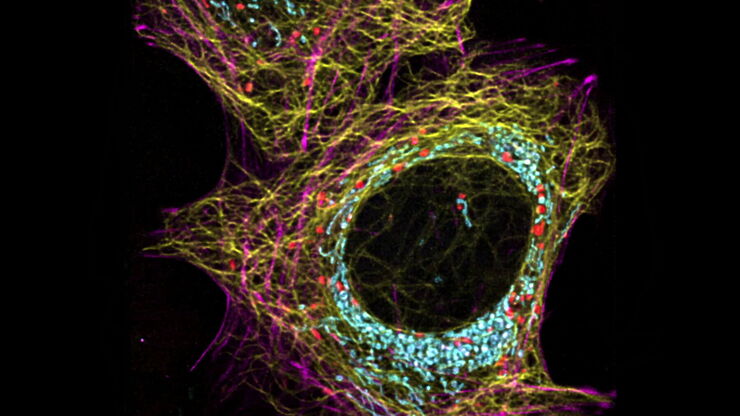 Dynamic Signal Enhancement powered by Aivia: Truly simultaneous multicolor imaging of live cells (U2OS) in 3D Dynamic Signal Enhancement powered by Aivia: Truly simultaneous multicolor imaging of live cells (U2OS) in 3D