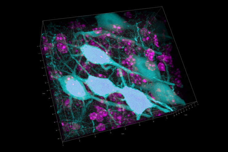 3D Reconstruction of brain slide image_Mica