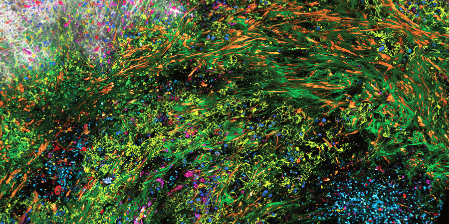 3D high-plex imaging in cancer immunology. Overview of a pancreatic tumor section in mouse model, labeled with 15 markers and imaged in one go using STELLARIS with SpectraPlex. (https://www.nature.com/articles/d42473-024-00260-7)