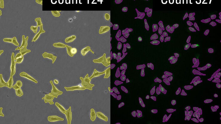 AI-based cell counting performed with a phase-contrast and fluorescence image using the Mateo FL microscope. AI-based cell counting performed with a phase-contrast and fluorescence image using the Mateo FL microscope.