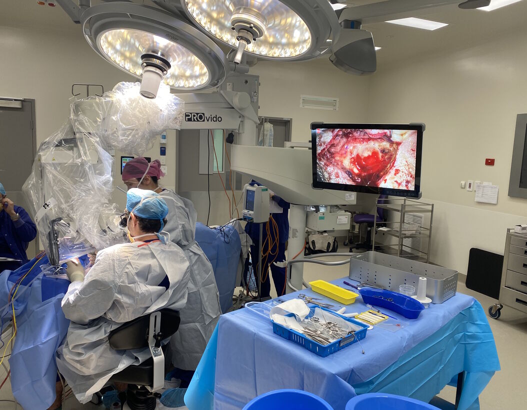 According to Dr. Flanagan, the PROvido IVA surgical microscope provides optimal visualization, supporting the needs of tympanoplasty surgery. Image courtesy of Dr. Sean Flanagan. According to Dr. Flanagan, the PROvido IVA surgical microscope provides optimal visualization, supporting the needs of tympanoplasty surgery. Image courtesy of Dr. Sean Flanagan. Tympanoplasty_surgery_with_PROvido_IVA_by_Dr._Flanagan.jpg